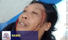 Prof. Dr. Sutan Nasomal: Minta Dewan Pers Mengawal Pemukulan Wartawan di Kolut – Tak Boleh Didiamkan! KAPOLRI & KAPOLDA SULTRA DIMINTA TURUN TANGAN!